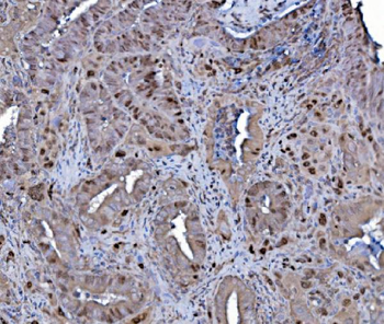 MCM4 Rabbit Polyclonal Antibody
