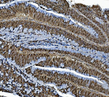 MCM4 Rabbit Polyclonal Antibody
