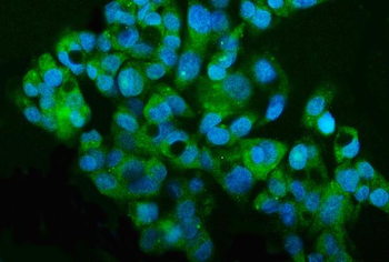 MT2-MMP/MMP15/MT2 Rabbit Polyclonal Antibody