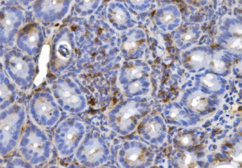 CD20/MS4A1 Rabbit Polyclonal Antibody