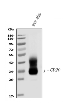 CD20/MS4A1 Rabbit Polyclonal Antibody