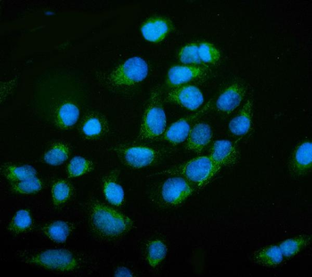 NCAM1 Rabbit Polyclonal Antibody