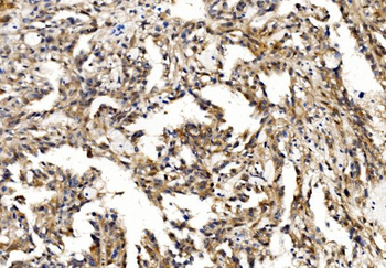 Profilin 2/PFN2 Rabbit Polyclonal Antibody