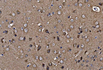 Profilin 2/PFN2 Rabbit Polyclonal Antibody