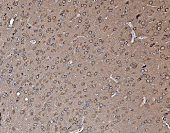 Profilin 2/PFN2 Rabbit Polyclonal Antibody