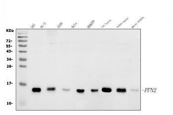 Profilin 2/PFN2 Rabbit Polyclonal Antibody