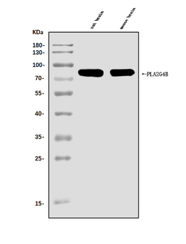 cPLA2 beta/PLA2G4B Rabbit Polyclonal Antibody