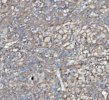 Poliovirus Receptor/PVR Rabbit Polyclonal Antibody