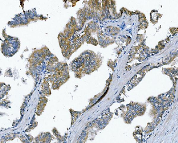 Poliovirus Receptor/PVR Rabbit Polyclonal Antibody