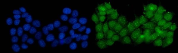Serum Response Factor/SRF Rabbit Polyclonal Antibody