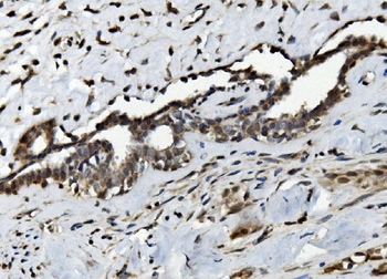 Serum Response Factor/SRF Rabbit Polyclonal Antibody