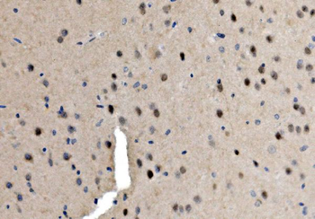 Serum Response Factor/SRF Rabbit Polyclonal Antibody