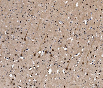 Serum Response Factor/SRF Rabbit Polyclonal Antibody