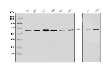 Serum Response Factor/SRF Rabbit Polyclonal Antibody