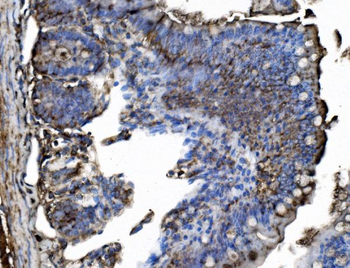TRIM25/EFP Rabbit Polyclonal Antibody