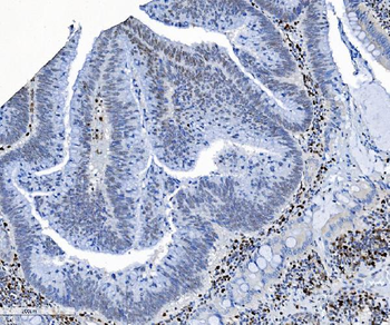 SAMHD1 Mouse Monoclonal Antibody