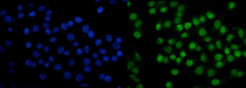 SAMHD1 Mouse Monoclonal Antibody