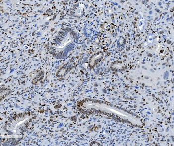 SAMHD1 Mouse Monoclonal Antibody