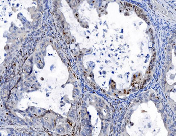 SAMHD1 Mouse Monoclonal Antibody