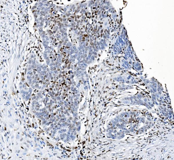 SAMHD1 Mouse Monoclonal Antibody