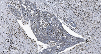 SAMHD1 Mouse Monoclonal Antibody
