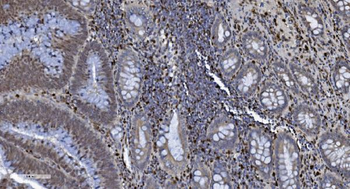 SAMHD1 Mouse Monoclonal Antibody