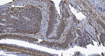 SAMHD1 Mouse Monoclonal Antibody