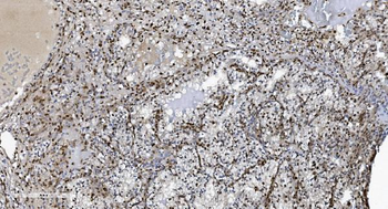 SAMHD1 Mouse Monoclonal Antibody