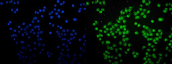 SAMHD1 Mouse Monoclonal Antibody