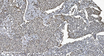 SAMHD1 Mouse Monoclonal Antibody
