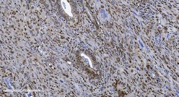 SAMHD1 Mouse Monoclonal Antibody