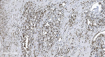 SAMHD1 Mouse Monoclonal Antibody