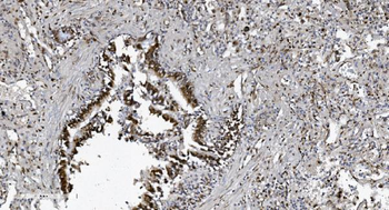 SAMHD1 Mouse Monoclonal Antibody