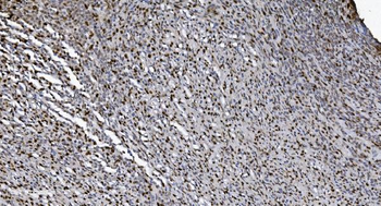 SAMHD1 Mouse Monoclonal Antibody
