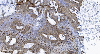 SAMHD1 Mouse Monoclonal Antibody