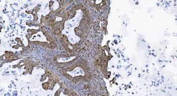 SAMHD1 Mouse Monoclonal Antibody