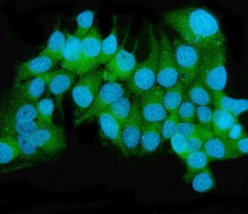 MEK2/MAP2K2 Mouse Monoclonal Antibody