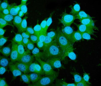 MEK2/MAP2K2 Mouse Monoclonal Antibody
