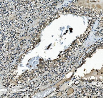 MEK2/MAP2K2 Mouse Monoclonal Antibody