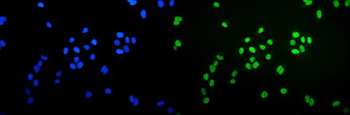 Ku70 Mouse Monoclonal Antibody