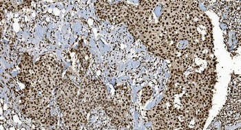 Ku70 Mouse Monoclonal Antibody