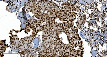 Ku70 Mouse Monoclonal Antibody