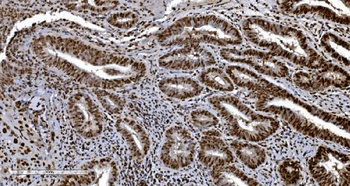 Ku70 Mouse Monoclonal Antibody