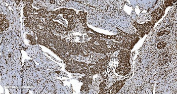 Ku70 Mouse Monoclonal Antibody