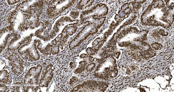 Ku70 Mouse Monoclonal Antibody