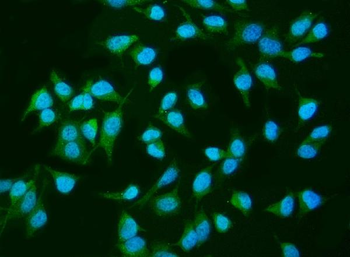 INPPL1 Mouse Monoclonal Antibody