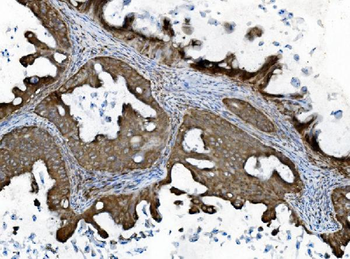 INPPL1 Mouse Monoclonal Antibody