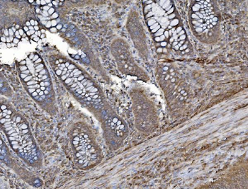 INPPL1 Mouse Monoclonal Antibody