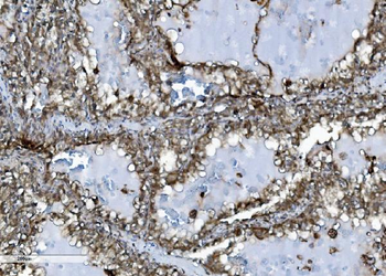 INPPL1 Mouse Monoclonal Antibody