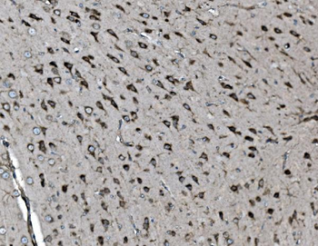 INPPL1 Mouse Monoclonal Antibody